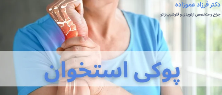 درباره پوکی استخوان
