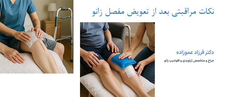 نکات مراقبتی بعد از تعویض مفصل زانو