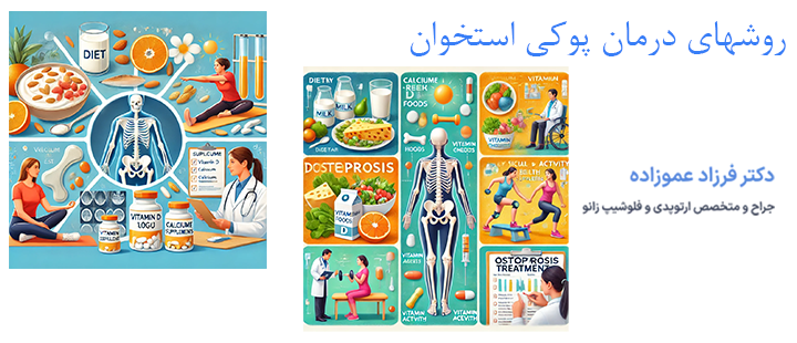 روش های درمان پوکی استخوان به چه صورت است؟