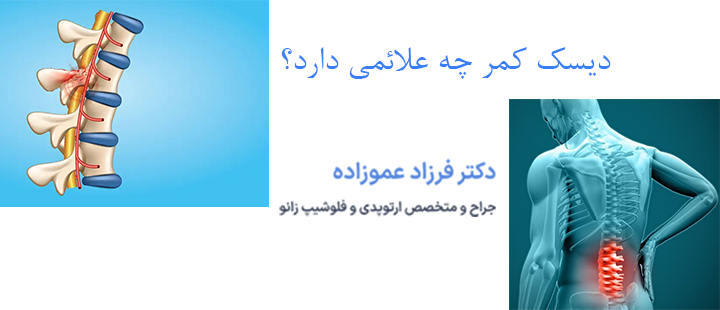 دیسک کمر چه علائمی دارد؟