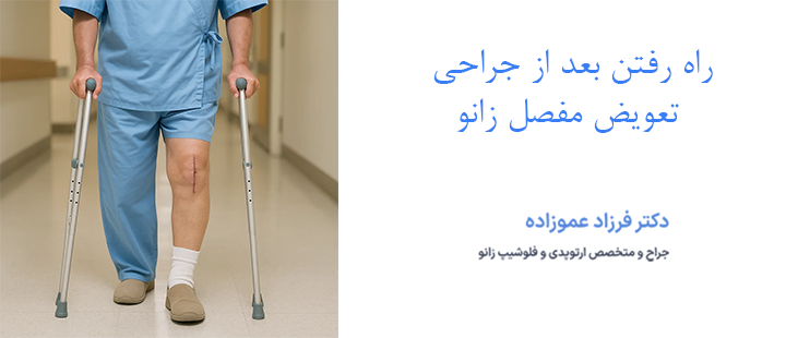 راه رفتن بعد از تعویض مفصل زانو