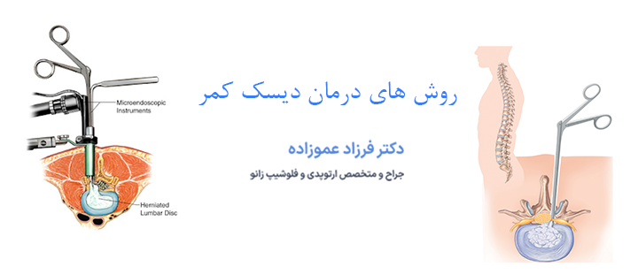 روش های درمان دیسک کمر