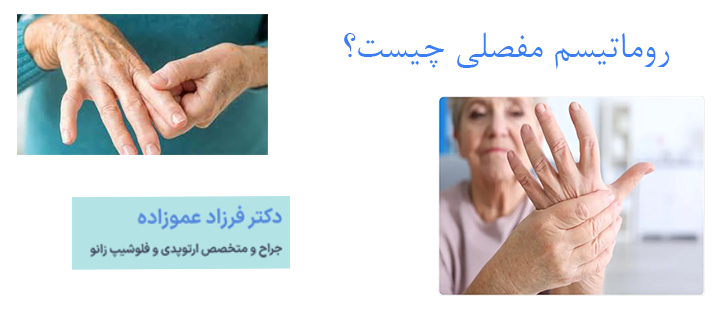 روماتیسم مفصلی چیست؟