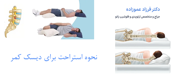 نحوه استراحت برای دیسک کمر