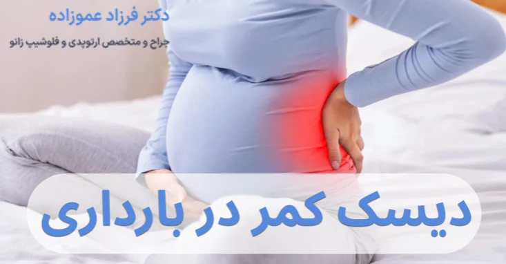دیسک کمر در بارداری