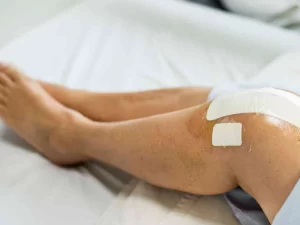 خوابیدن بعد از تعویض مفصل زانو