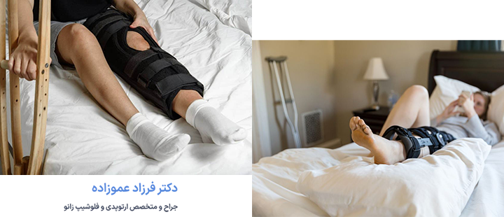 نحوه خوابیدن بعد از تعویض مفصل زانو
