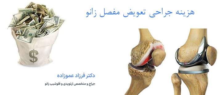 درباره هزینه جراحی تعویض مفصل زانو