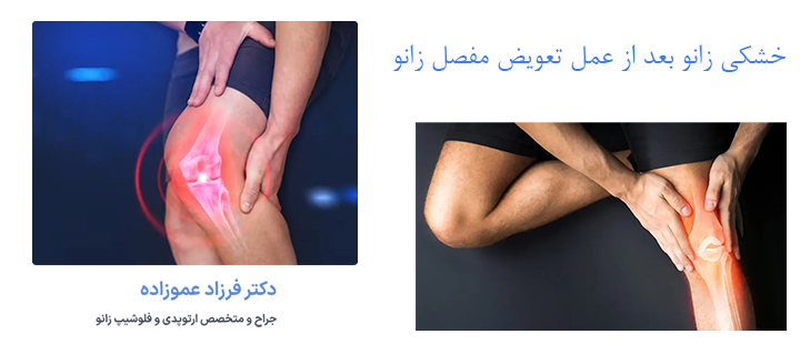 علل خشکی زانو بعد از عمل تعویض مفصل زانو
