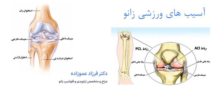درباره آسیب های ورزشی زانو