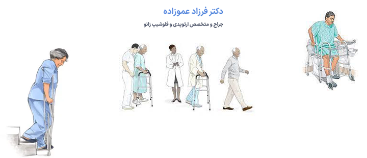 آشنایی با مراقبت های بعد از تعویض مفصل لگن