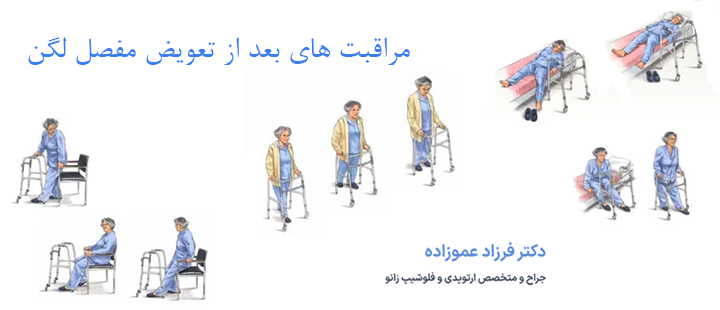 درباره مراقبت های بعد از تعویض مفصل لگن