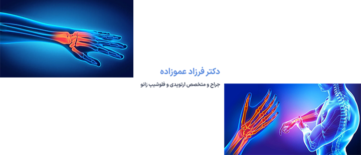 علل شکستگی استخوان دست
