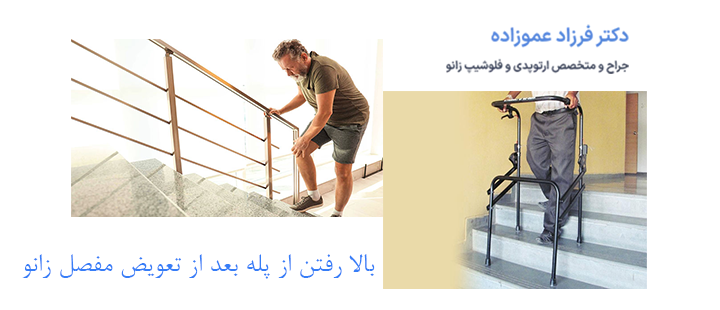 درباره بالا رفتن از پله بعد از تعویض مفصل زانو