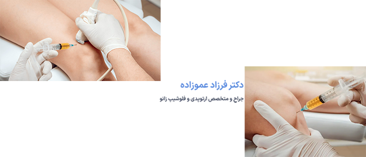 آشنایی با تزریق پی آر پی زانو