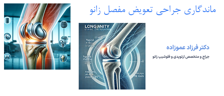 درباره ماندگاری جراحی تعویض مفصل زانو