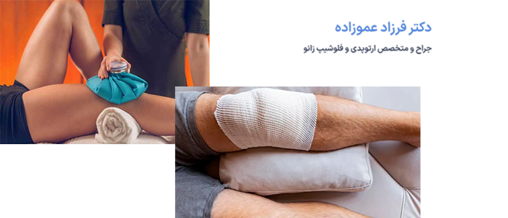 آشنایی با آرتروسکوپی زانو