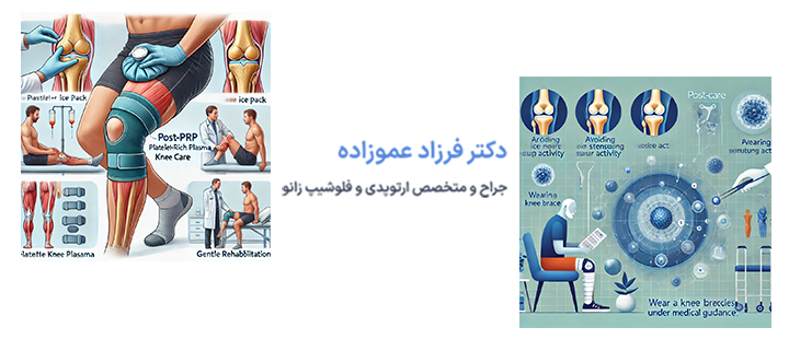 آشنایی با مراقبت های بعد از پی آر پی زانو