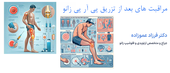 درباره مراقبت های بعد از پی آر پی زانو
