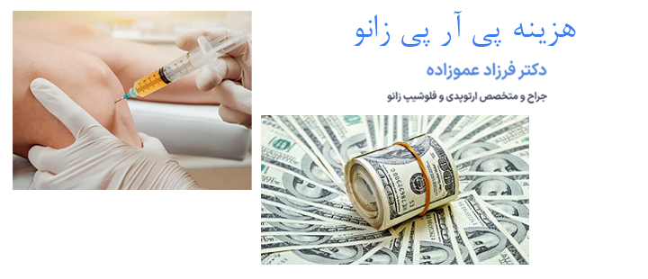 درباره هزینه پی آر پی زانو