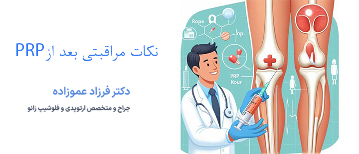نکات مراقبتی بعد از پی آر پی