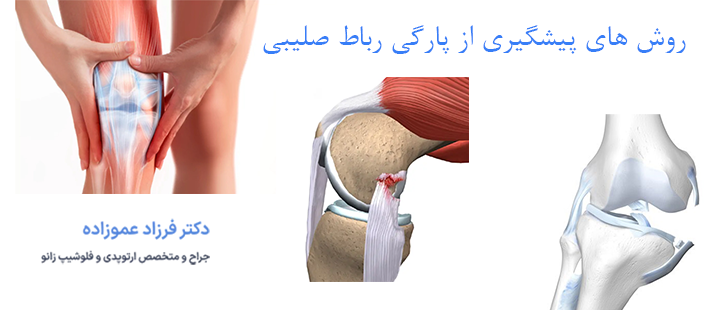 روش های پیشگیری از پارگی رباط صلیبی