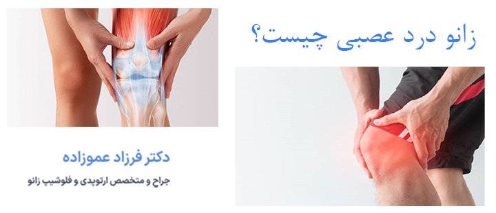 زانو درد عصبی چیست؟