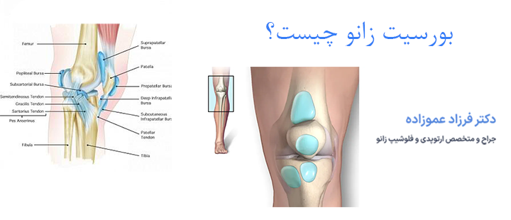 بورسیت زانو چیست؟