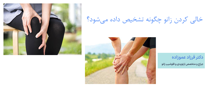 تشخیص خالی کردن زانو