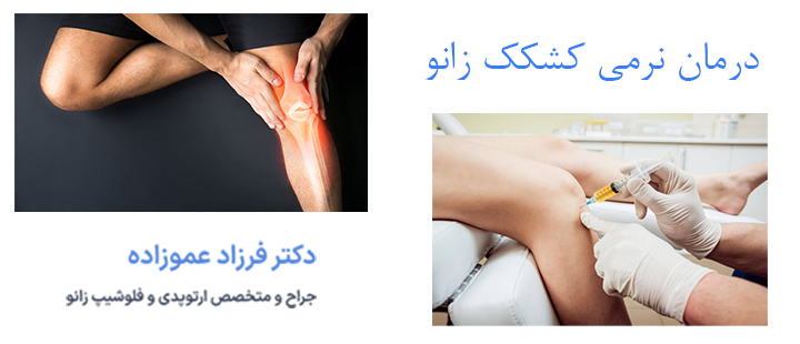 درمان نرمی کشکک زانو