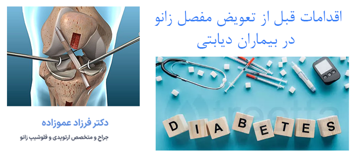 اقداماتی قبل از تعویض مفصل زانو