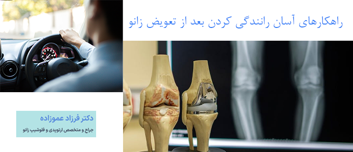 راهکارهای آسان رانندگی کردن بعد از تعویض زانو
