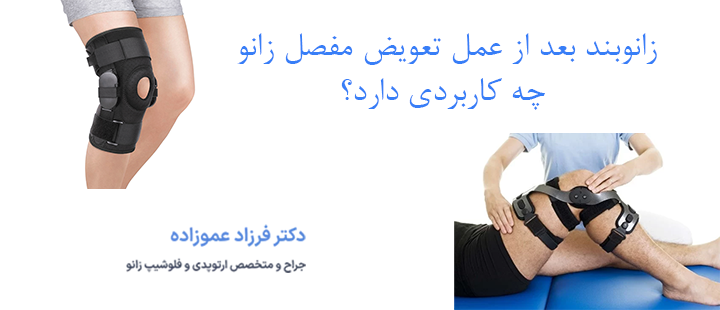 زانوبند بعد از تعویض مفصل زانو چه کاربردی دارد؟