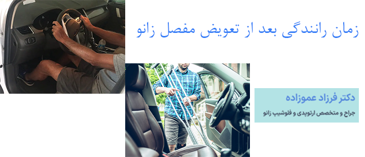 زمان رانندگی بعد از تعویض مفصل زانو