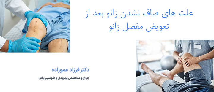 علت های صاف نشدن زانو بعد از تعویض مفصل زانو