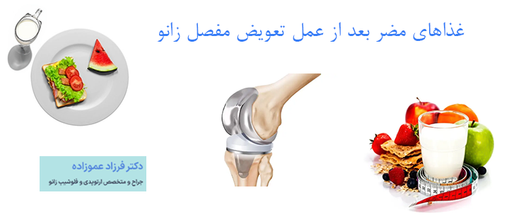 غذاهای مضر بعد از عمل تعویض مفصل زانو