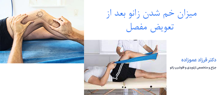 میزان خم شدن زانو بعد از تعویض مفصل