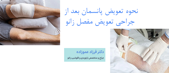 نحوه تعویض پانسمان بعد از جراحی تعویض مفصل زانو