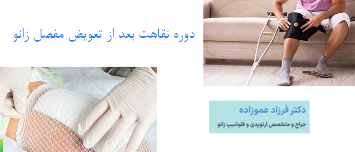 دوره نقاهت بعد از تعویض مفصل زانو چقدر طول میکشد؟