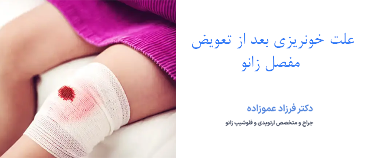 علت خونریزی بعد از تعویض مفصل زانو