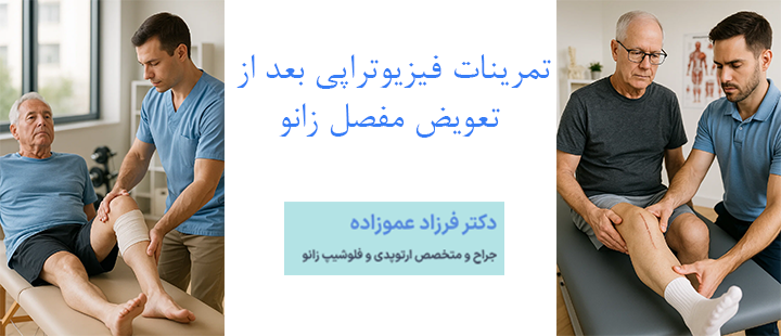 تمرینات فیزیوتراپی بعد از تعویض مفصل زانو
