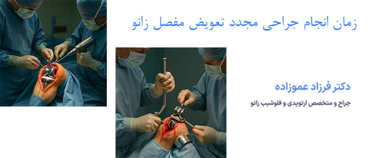 زمان انجام جراحی مجدد تعویض مفصل زانو