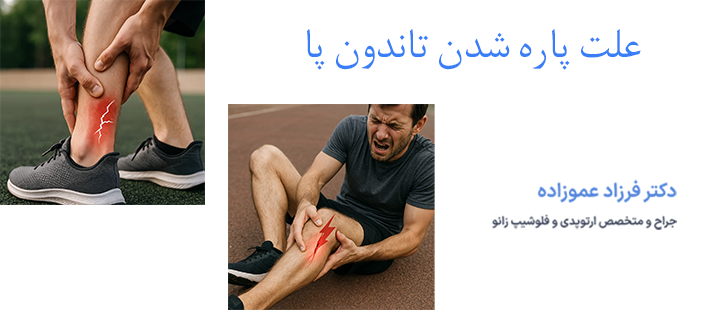 پارگی تاندون پا